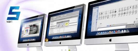 Disponibile la versione cloud di XDent, il software Mac per gli studi dentistici